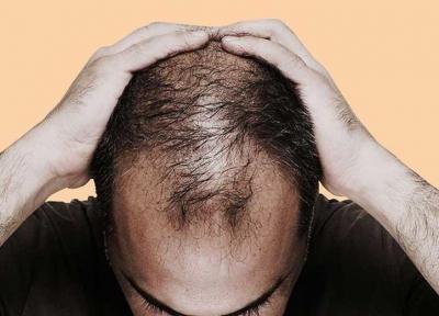 با خوردن این غذاها دیگر مو های تان نمی ریزد!